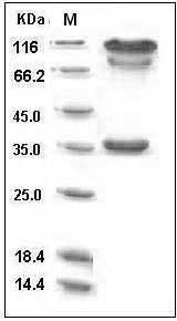 Human BACE1 / ASP2 Protein (Fc Tag) SDS-PAGE