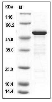 Mouse 14-3-3 epsilon / YWHAE Protein (GST Tag) SDS-PAGE
