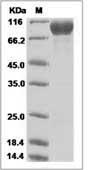 Mouse CD123 / IL3RA Protein (Fc Tag)