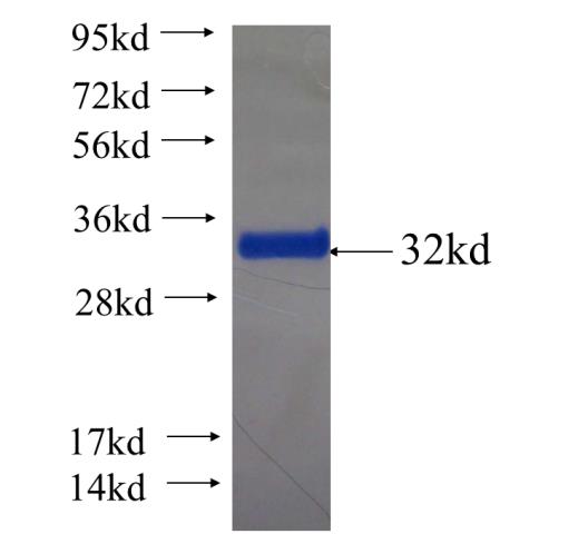 Recombinant human FAM133A SDS-PAGE