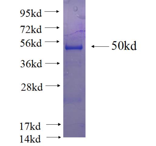 Recombinant human ZFYVE27 SDS-PAGE