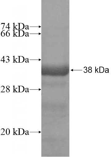 Recombinant Human LSR SDS-PAGE