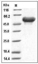 Mouse Arylsulfatase A / ARSA Protein (His Tag) SDS-PAGE