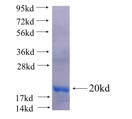 Recombinant human TBRG1(Full length) SDS-PAGE
