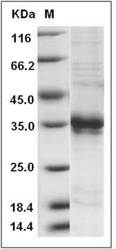 Rat ASAM / CLMP Protein (His Tag) SDS-PAGE