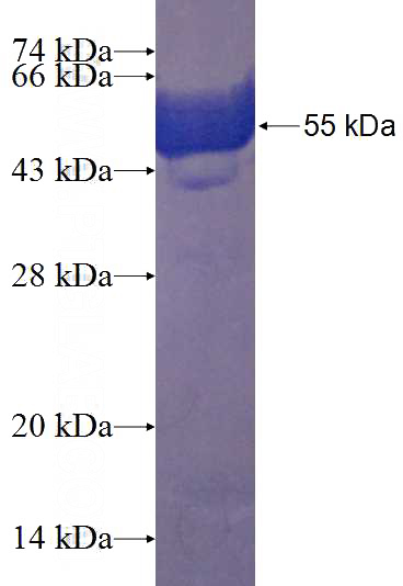 Recombinant Human ZC3H8 SDS-PAGE