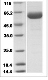 Rat C1 inhibitor / SerpinG1 Protein (His Tag)