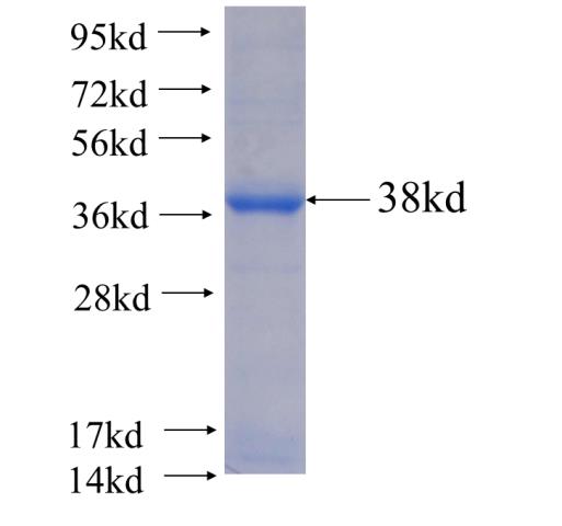 Recombinant human WDR6 SDS-PAGE