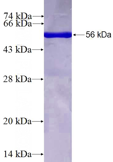 Recombinant Human GNPDA1 SDS-PAGE