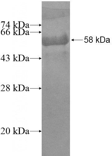 Recombinant Human EPS15L1 SDS-PAGE