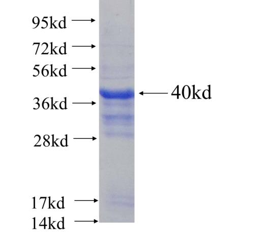 Recombinant human DHRS1(Full length) SDS-PAGE