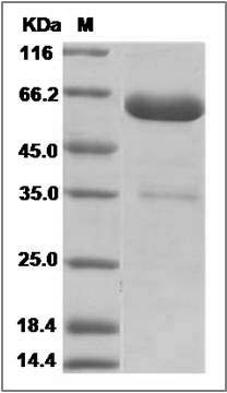 Mouse ANTXR2 / CMG2 Protein (Fc Tag) SDS-PAGE