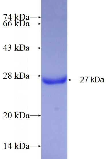 Recombinant Human CDK5R1 SDS-PAGE