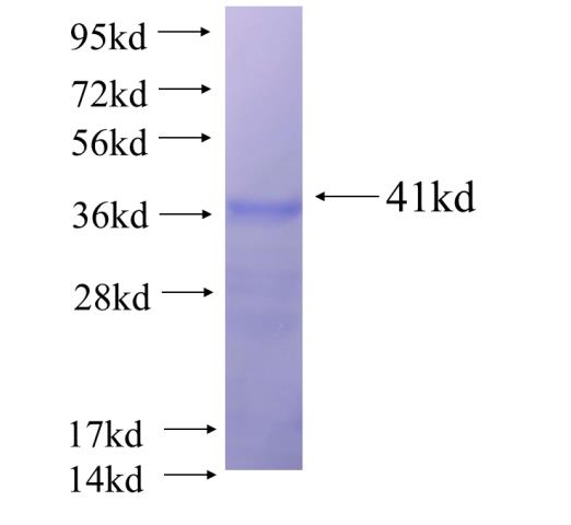 Recombinant human C14orf102 SDS-PAGE