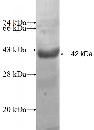 Recombinant Human MED31 SDS-PAGE