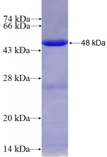 Recombinant Human PDE4D SDS-PAGE