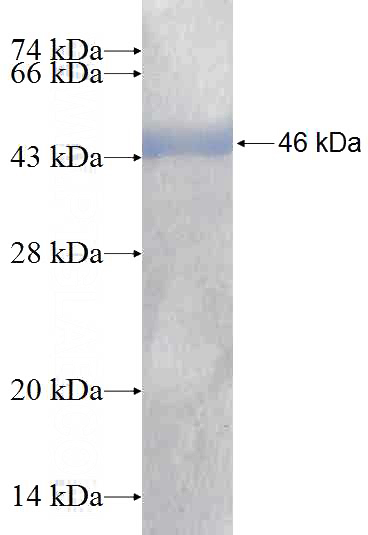 Recombinant Human SNUPN SDS-PAGE