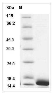 Human CALML3 Protein (His Tag) SDS-PAGE