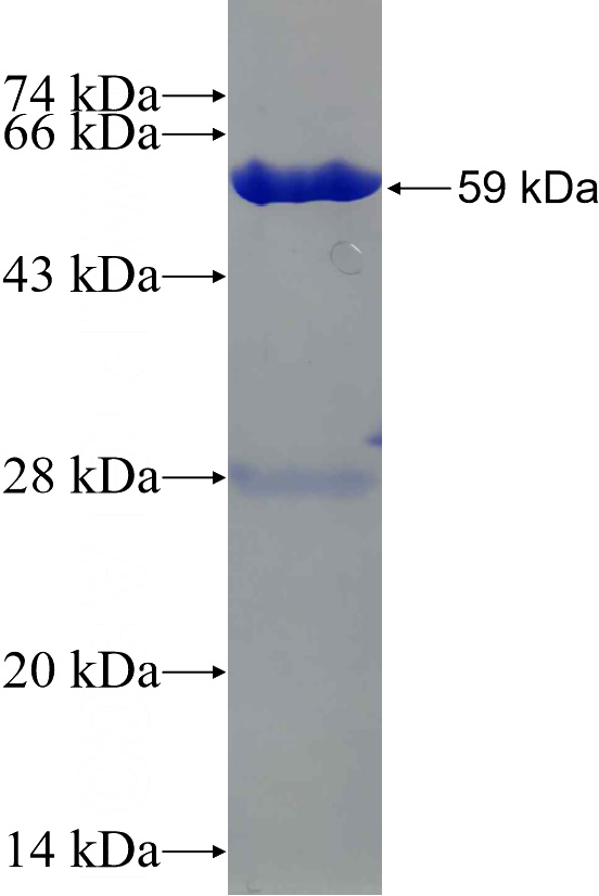 Recombinant Human TST SDS-PAGE