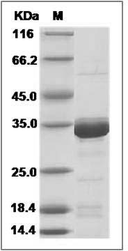 Human B3GAT3 / GLCATI Protein (His Tag) SDS-PAGE