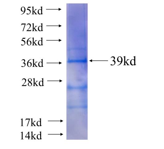 Recombinant human AEBP2(Full length) SDS-PAGE