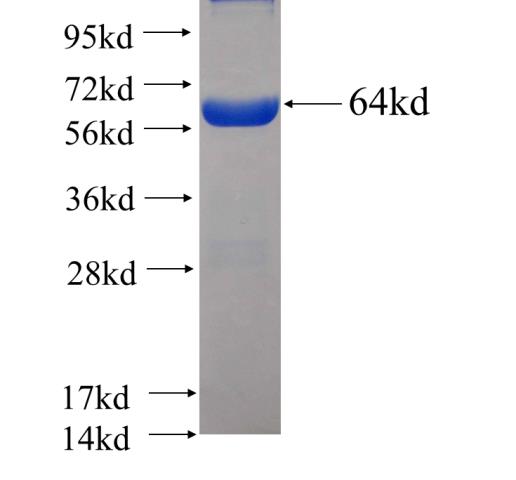 Recombinant human ESRRG SDS-PAGE