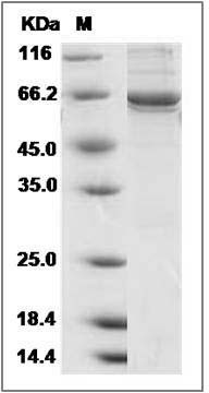 Human CARKL / SHPK Protein (His & GST Tag) SDS-PAGE