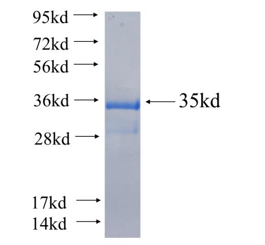Recombinant human FAM117B SDS-PAGE