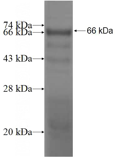 Recombinant Human GUCY1B3 SDS-PAGE