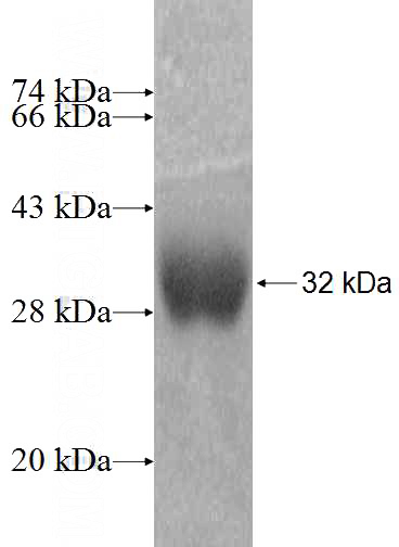 Recombinant Human LYPLAL1 SDS-PAGE