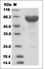 Cynomolgus IL20RB Protein (Fc Tag)