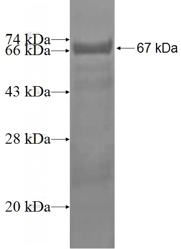 Recombinant Human TTRAP SDS-PAGE