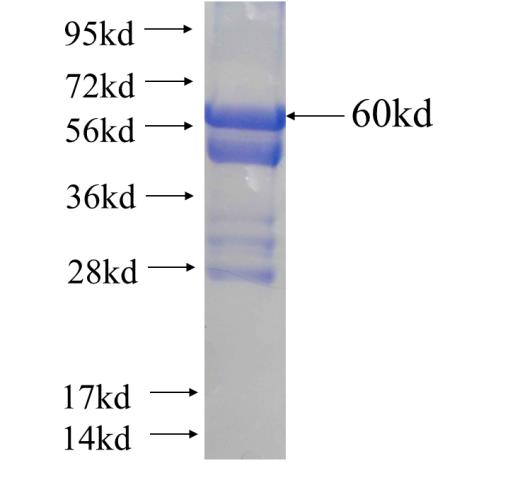Recombinant human DHRS1(Full length) SDS-PAGE