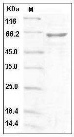 Human Latexin / LXN / TCI Protein (Fc Tag) SDS-PAGE