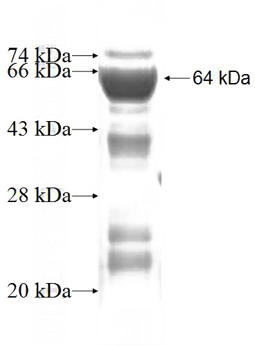 Recombinant Human HDGF2 SDS-PAGE