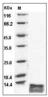 Human CCL17 / TARC / SCYA17 Protein (His Tag) SDS-PAGE