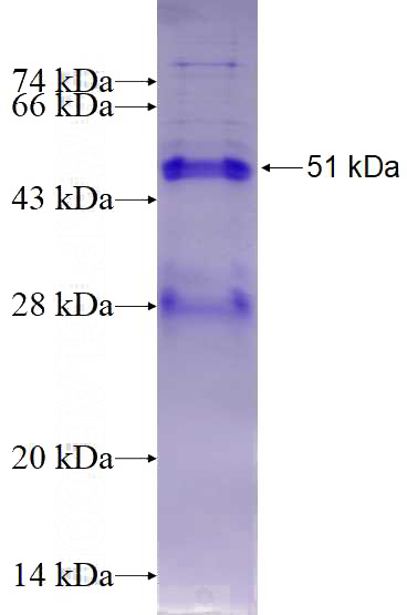 Recombinant Human OIP5 SDS-PAGE