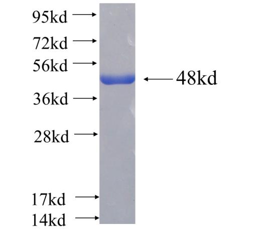 Recombinant human SAR1B(Full length) SDS-PAGE
