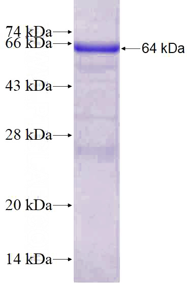 Recombinant Human TRIM38 SDS-PAGE