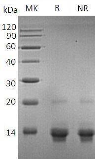 Human UCMA/C10orf49 recombinant protein