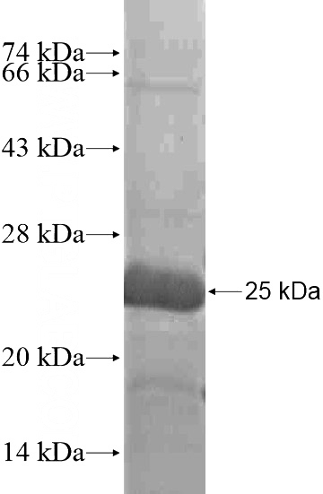 Recombinant Human ST3GAL3 SDS-PAGE
