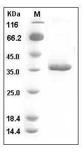 Mouse sFRP2 Protein (His Tag) SDS-PAGE