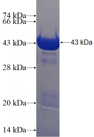 Recombinant Human CEP164 SDS-PAGE