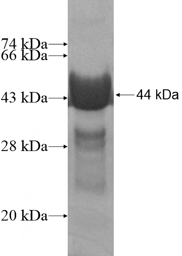 Recombinant Human C19orf43 SDS-PAGE