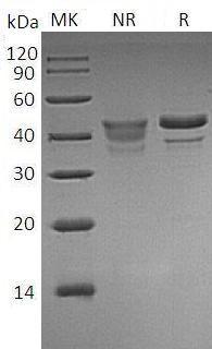 Human METAP1/KIAA0094 recombinant protein