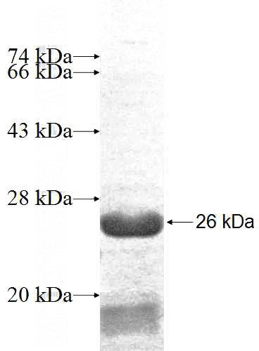 Recombinant Human MYL12A SDS-PAGE