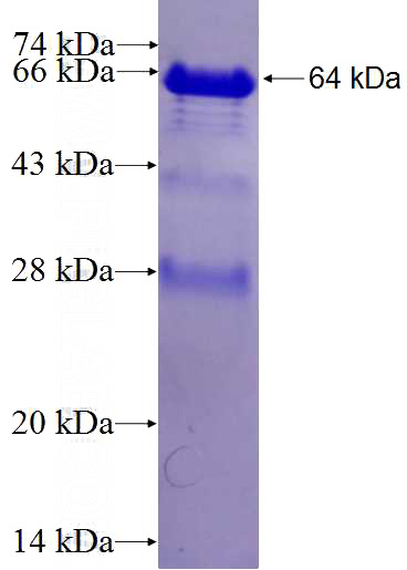Recombinant Human STAM SDS-PAGE