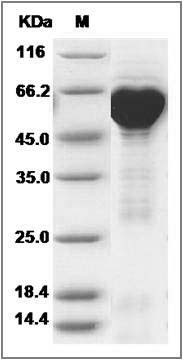Human HSPD1 / HSP60 Protein (His & GST Tag) SDS-PAGE