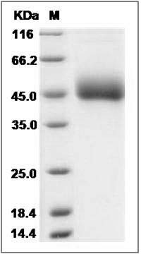 Human MBD2 / DPEP2 Protein (His Tag) SDS-PAGE