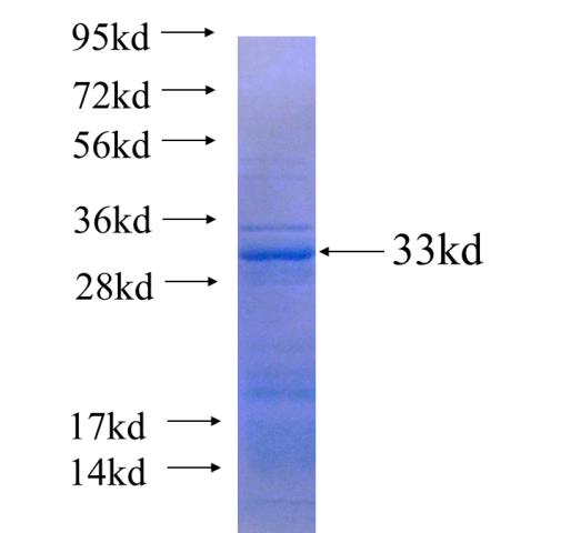 Recombinant human CCDC42 SDS-PAGE